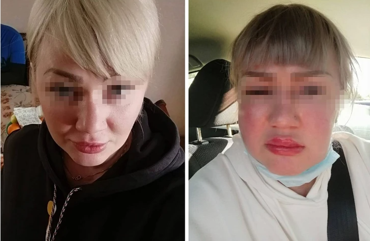 Ангарчанка стала жертвой косметолога
